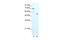 Zinc Finger Protein 665 antibody, A17641, Boster Biological Technology, Western Blot image 