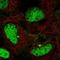 Lysosomal Trafficking Regulator antibody, HPA055725, Atlas Antibodies, Immunofluorescence image 