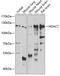 Histone Deacetylase 7 antibody, GTX55655, GeneTex, Western Blot image 