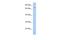 Signal Recognition Particle 72 antibody, A05873, Boster Biological Technology, Western Blot image 