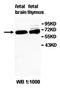 Zinc Finger Protein 131 antibody, orb77954, Biorbyt, Western Blot image 