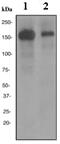 Complement C3d Receptor 2 antibody, ab75985, Abcam, Western Blot image 