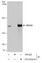 Rho Associated Coiled-Coil Containing Protein Kinase 2 antibody, GTX102619, GeneTex, Immunoprecipitation image 