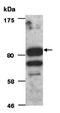 Helicase, Lymphoid Specific antibody, orb66740, Biorbyt, Western Blot image 