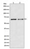 Activin A Receptor Type 2B antibody, M04653, Boster Biological Technology, Western Blot image 