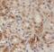 Phosducin Like 2 antibody, FNab06246, FineTest, Immunohistochemistry paraffin image 