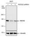 Rho Associated Coiled-Coil Containing Protein Kinase 2 antibody, PA5-78290, Invitrogen Antibodies, Western Blot image 