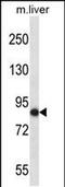 NIMA Related Kinase 5 antibody, PA5-48697, Invitrogen Antibodies, Western Blot image 