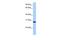 Cyclin Dependent Kinase Inhibitor 3 antibody, GTX45484, GeneTex, Western Blot image 