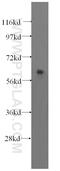 TRNA Methyltransferase 6 antibody, 16727-1-AP, Proteintech Group, Western Blot image 