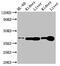 ADK antibody, CSB-PA346232LA01HU, Cusabio, Western Blot image 