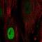 Cyclin D1 antibody, NBP2-58667, Novus Biologicals, Immunofluorescence image 