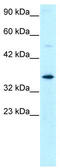 General Transcription Factor IIH Subunit 3 antibody, TA329285, Origene, Western Blot image 