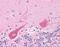 Ubiquitin Protein Ligase E3A antibody, GTX70169, GeneTex, Immunohistochemistry paraffin image 
