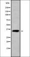 Phosphatidylinositol Glycan Anchor Biosynthesis Class C antibody, orb338539, Biorbyt, Western Blot image 
