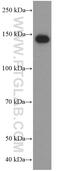 CD11C antibody, 60258-1-Ig, Proteintech Group, Western Blot image 