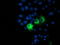 Protein Phosphatase, Mg2+/Mn2+ Dependent 1B antibody, LS-C172954, Lifespan Biosciences, Immunofluorescence image 