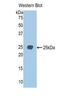 Jagged Canonical Notch Ligand 1 antibody, LS-C299887, Lifespan Biosciences, Western Blot image 