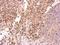 Piwi Like RNA-Mediated Gene Silencing 4 antibody, GTX119387, GeneTex, Immunohistochemistry paraffin image 