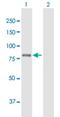 Phospholipase A2 Group VI antibody, H00008398-B01P, Novus Biologicals, Western Blot image 