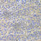 Signal Transducer And Activator Of Transcription 4 antibody, A6991, ABclonal Technology, Immunohistochemistry paraffin image 