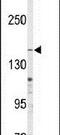 ATP Binding Cassette Subfamily C Member 4 antibody, PA5-14337, Invitrogen Antibodies, Western Blot image 