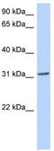 Goosecoid Homeobox antibody, TA330186, Origene, Western Blot image 