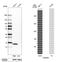 Cellular Retinoic Acid Binding Protein 2 antibody, HPA004135, Atlas Antibodies, Western Blot image 