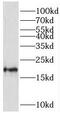Transmembrane Protein 35A antibody, FNab08779, FineTest, Western Blot image 