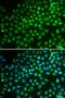 SWI/SNF-related matrix-associated actin-dependent regulator of chromatin subfamily A member 5 antibody, orb154213, Biorbyt, Immunocytochemistry image 
