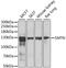 Smoothelin antibody, A04895-1, Boster Biological Technology, Western Blot image 