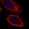 Interleukin 20 Receptor Subunit Beta antibody, NBP2-68814, Novus Biologicals, Immunocytochemistry image 