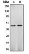 Caspase 4 antibody, LS-C351915, Lifespan Biosciences, Western Blot image 