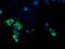 Pyruvate Dehydrogenase E1 Alpha 1 Subunit antibody, LS-C172860, Lifespan Biosciences, Immunofluorescence image 