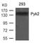 Protein-tyrosine kinase 2-beta antibody, 79-362, ProSci, Western Blot image 