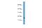 Chromosome 17 Open Reading Frame 64 antibody, A19189, Boster Biological Technology, Western Blot image 