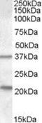 Tumor Suppressor Candidate 3 antibody, PA5-18893, Invitrogen Antibodies, Western Blot image 