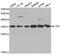 Interleukin 1 Receptor Type 2 antibody, MBS2522965, MyBioSource, Western Blot image 