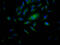Ribosomal Protein S6 Kinase B1 antibody, CSB-RA299200A0HU, Cusabio, Immunofluorescence image 