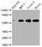 P21 (RAC1) Activated Kinase 1 antibody, CSB-RA287160A0HU, Cusabio, Western Blot image 