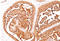 Polymorphic epithelial mucin antibody, AM10082PU-T, Origene, Immunohistochemistry frozen image 