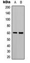 Transcription Factor 4 antibody, orb304625, Biorbyt, Western Blot image 