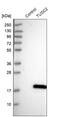 CD3d Molecule antibody, NBP1-86794, Novus Biologicals, Western Blot image 