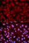 Synuclein Gamma antibody, 18-688, ProSci, Immunofluorescence image 