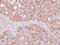 Enoyl-CoA Hydratase, Short Chain 1 antibody, NBP2-16263, Novus Biologicals, Immunohistochemistry frozen image 