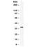 C-X-C Motif Chemokine Ligand 10 antibody, R31873, NSJ Bioreagents, Western Blot image 