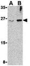 Interleukin-32 antibody, GTX85069, GeneTex, Western Blot image 