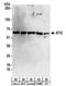 5-Aminoimidazole-4-Carboxamide Ribonucleotide Formyltransferase/IMP Cyclohydrolase antibody, NBP2-32184, Novus Biologicals, Western Blot image 
