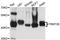 TRNA Methyltransferase 2 Homolog B antibody, A3509, ABclonal Technology, Western Blot image 