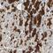 Mitogen-Activated Protein Kinase Kinase Kinase 7 antibody, HPA007633, Atlas Antibodies, Immunohistochemistry paraffin image 